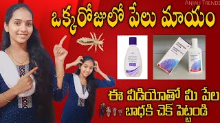 ఏ side effects లేకుండా low budget లో ఒక్క రోజులో పేలు మాయం Clear head lice amp Nits  Anjali Trends [upl. by Sandell453]