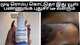 wishcare hair growth serum review tamil hairregrowth foreheadhairgrowth hairdensity [upl. by Kamp]