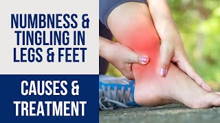 Leg amp Foot Numbness amp Tingling Diagnosis amp Treatment [upl. by Atiuqrahs]