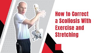 How to Correct a Scoliosis With Exercise and Stretching  Ed Paget [upl. by Attenauq685]