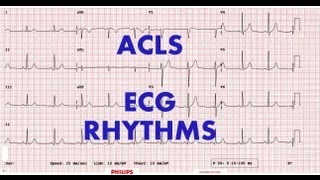 ACLS  ECG rhythm recognition amp management Part 1 [upl. by Joelynn73]