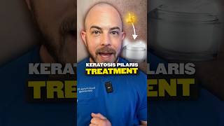 What is keratosis pilaris Derm explains keratosispilaris [upl. by Koblas]