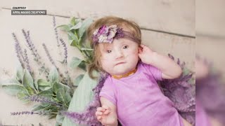 Indiana family adopts baby with rare genetic disorder [upl. by Massiw]