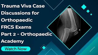 Trauma Viva Case Discussions for Orthopaedic FRCS Exams  Part II  Orthopaedic Academy [upl. by Samantha502]