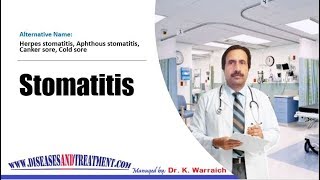 Stomatitis  Causes Diagnosis Symptoms Treatment Prognosis [upl. by Filiano]