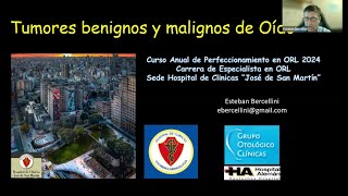 22102024  Tumores Benignos y Malignos de Oído [upl. by Evanthe707]