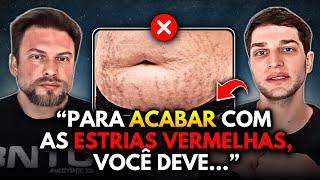 COMO SUMIR COM AS ESTRIAS VERMELHAS DE UMA VEZ  Muzy Explica [upl. by Araas]