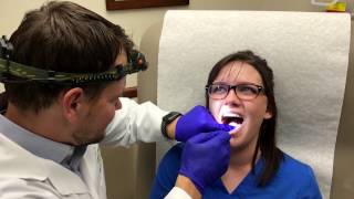 Canker Sore Treatment by Dermatologist Dr David Myers [upl. by Per]