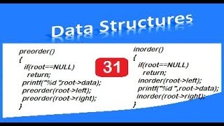 inorder preorder and postorder traversal with coding [upl. by Phelgen367]