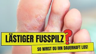 Lästiger FUSSPILZ So wirst du ihn los [upl. by Enelyar]