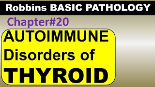 Ch20  Autoimmune Thyroid Pathology  Graves Disease  Hashimoto Robbins Pathology [upl. by Lamar]