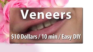 10 Veneers DIY at home  DIY Show Very cheap Apply yourself at home [upl. by Eeliak182]