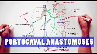 Portocaval Anastomoses  ANATOMY Tutorial [upl. by Let134]