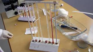 Erythrocyte sedimentation rate [upl. by Inele421]