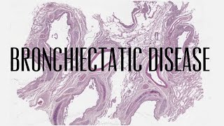 4 Bronchiectatic disease [upl. by Airalednac]