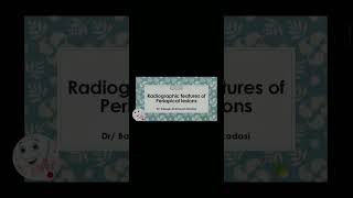 بثًا مباشرًا لمحاضرة Radiographic features of periapical lesions للدكتور quot بليغ القدسيquot✨🤩 [upl. by Nileve461]