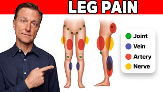 The 11 Causes of Leg Pain Revealed [upl. by Suh805]