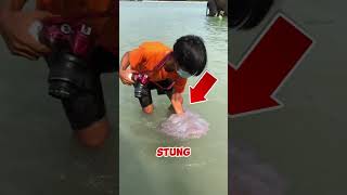 How To Live a Jellyfish Attack😳😱 [upl. by Ahsel6]