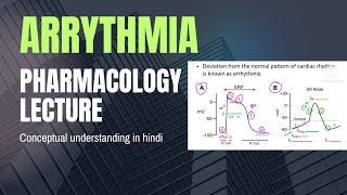 Treatment of Cardiac arrhythmia Pharmacology lectures Cardio vascular system pharmacologylectures [upl. by Dleifyar]