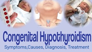 Congenital Hypothyroidism  Hypothyroidism in Infants  Symptoms Causes Diagnosis and Treatment [upl. by Amitaf]