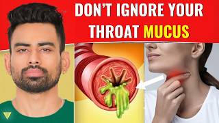 How to Clear Excess Throat Mucus [upl. by Yenduhc]