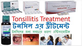 টনসিলের ট্রীটমেন্ট Tonsillitis Treatment Bong Pharma [upl. by Nierman]