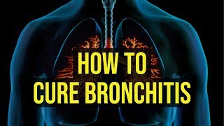 The REAL Cause of a Constant Phlegmy Mucus Throat [upl. by Sacha]