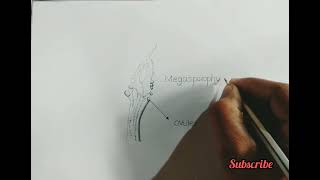 megasporophyll of cycas  how to draw megasporophyll of cycas  megasporophyll angiosperms [upl. by Ellehcrad539]