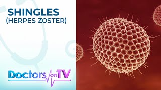 Symptoms Treatment amp Prevention of Shingles Herpes Zoster  Doctors on TV [upl. by Nodnnarb]