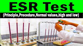 Erythrocyte sedimentation rate  ESR PrincipleProcedureNormal valueshigh and low [upl. by Anasor]