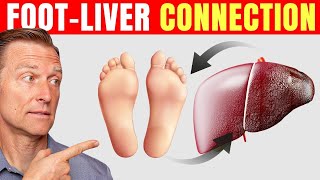 How to Use Your Feet to Diagnose Liver Problems—Dr Berg Explains [upl. by Dragon]