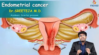 Endometrial Cancer  Obstetrics and gynaecology Video lectures Version 20  Medvizz app [upl. by Ailedroc177]