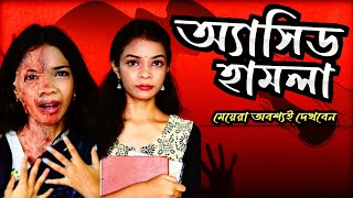 অ্যাসিড হামলা ll Acid Attack ll মেয়েরা অবশ্যই দেখবেন ll ALSI YT ll [upl. by Lemra]