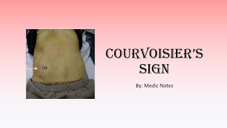 Courvoisiers sign pathophysiology Courvoisiers law [upl. by Suhpesoj]