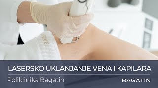 Lasersko uklanjanje vena i kapilara u Poliklinici Bagatin [upl. by Assehc]