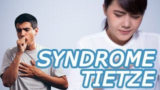 Sering Sakit Dada amp Tulang Rusuk Waspada Terserang Syndrome Tietze [upl. by Anaahs]