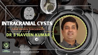 INTRA CRANIAL CYSTS  DR S NAVEEN KUMAR  Arachnoid Cyst  Leptomeningeal cyst  Tumors and cysts [upl. by Sinned]