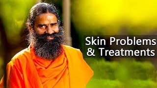 Skin Problems amp Treatments  Swami Ramdev [upl. by Lynne]