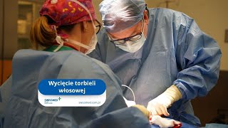 Operacja torbieli włosowej  Gastrologia i Proktologia  Swissmed [upl. by Nickey]