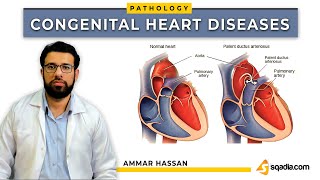 Congenital Heart Diseases  Introduction and Classification  Pathology Lectures  VLearning™ [upl. by Joselyn]