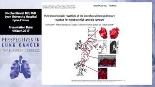 Carcinoids large cell neuroendocrine carcinoma thymoma and thymic carcinomas [upl. by Sinnelg82]