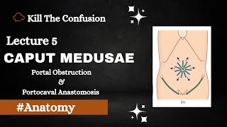 Caput Medusae  Portal Obstruction  Portocaval Anastomosis  Umbilicus  Abdomen Anatomy  KTC [upl. by Gweneth162]