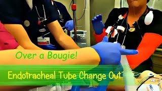 ET Tube Change Out Over a Bougie [upl. by Htebzil]