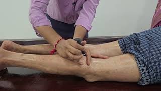 Moxibustion Therapy Learn from Experts in the Field DrShashikant Moxibustion Acupuncture imwell [upl. by Ezmeralda278]