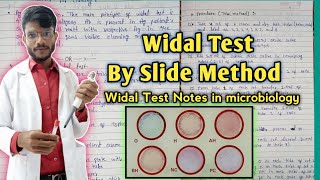 Widal test by Slide Method in hindiwidal test notes in microbiology widaltest [upl. by Dieterich175]