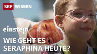 Ein Frühchen damals und heute – Vom Überlebenskampf zur Lebensfreude  Einstein  SRF Wissen [upl. by Sera]