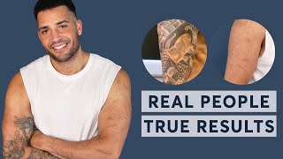 Laser Tattoo Removal  Real People True Results 2023 [upl. by Schechinger581]