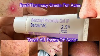 Benzac AC Cream Review  benzac ac 25 review  Benzoyl Peroxide For Acne [upl. by Abigael]