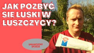 🔥Jak pozbyć się łuski w łuszczycy Sprawdzony sposób [upl. by Murage]