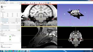 5 3D Slicer  Rotate Fiducials for Stereotaxic Alignment [upl. by Carina]